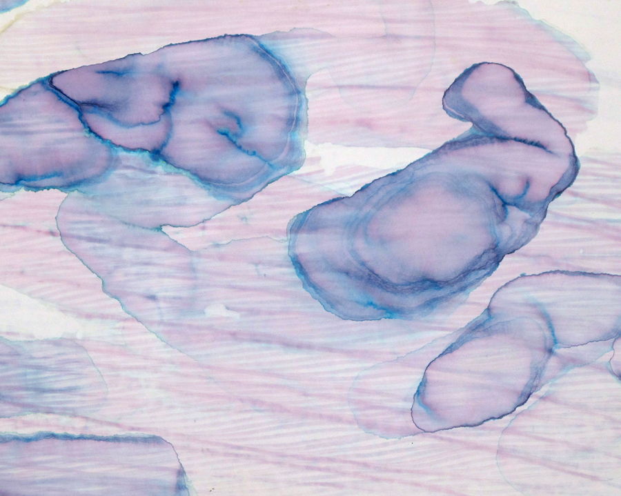 Levitující embrya, 2018